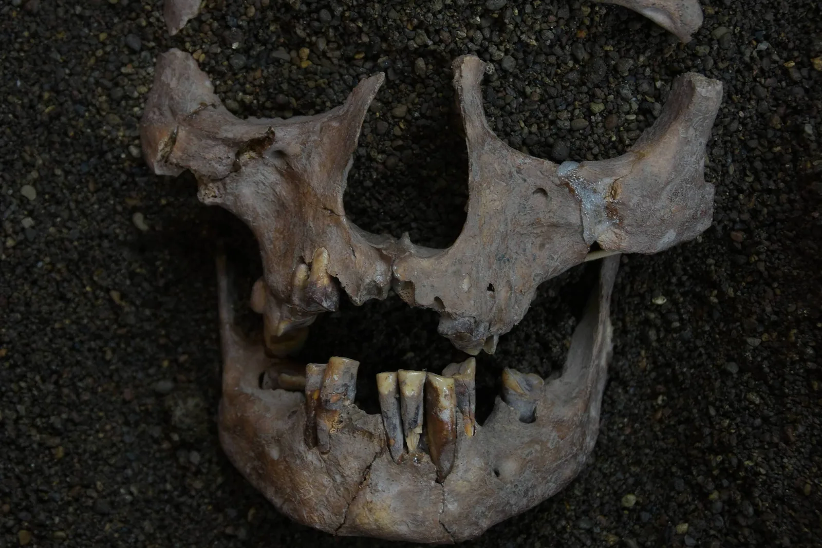 Moléculas preservadas nos dentes apontam consumo de noz-de-betel em Sulawesi