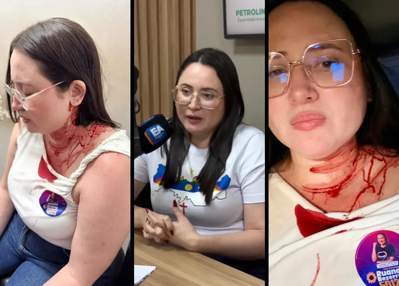 Candidata do Psol é ferida na cabeça durante caminhada em Ouricuri