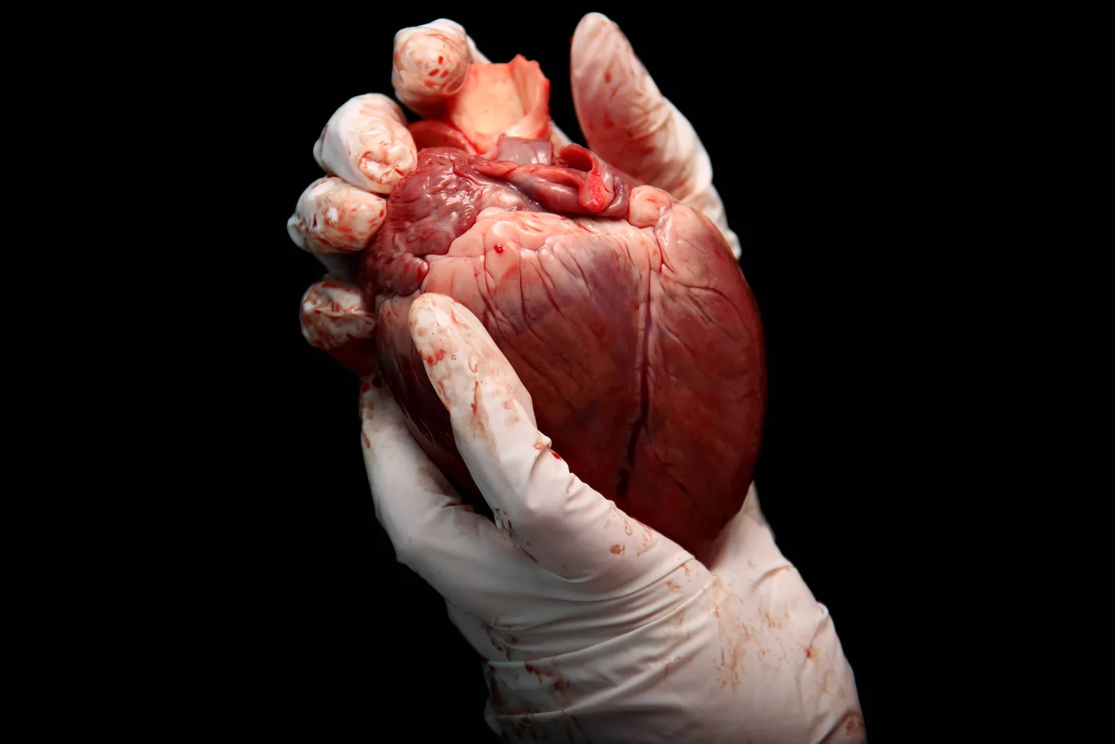 Estudo indica que coração transplantado pode acompanhar idade do receptor